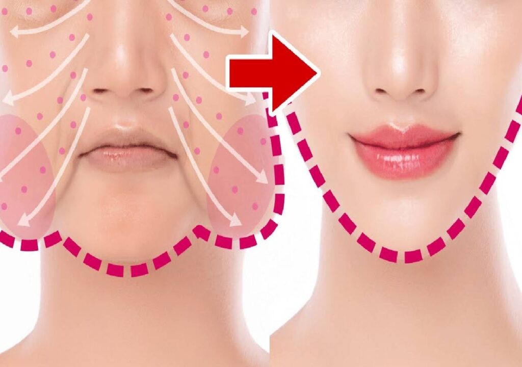 How To Remove Buccal Fat Cheek Fat Chubby Cheeks