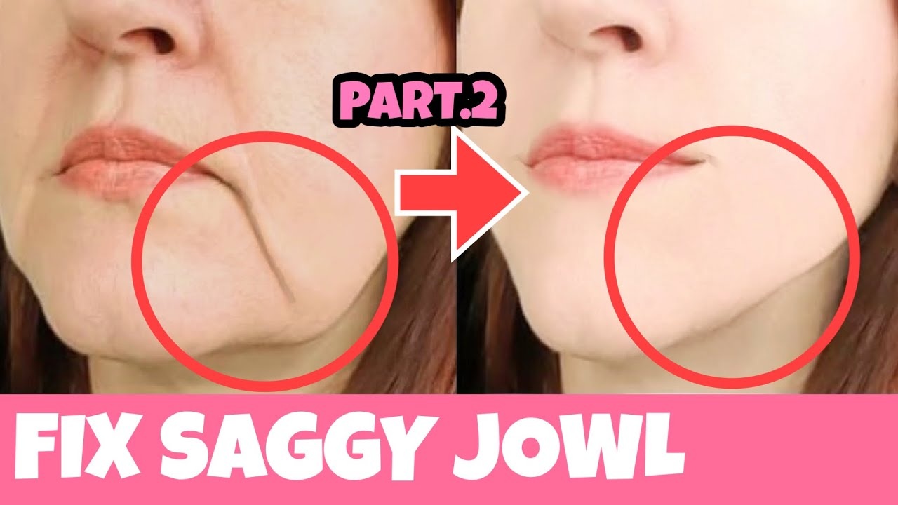 Anti Aging Face Lifting Exercises For Sagging Jowls Part2