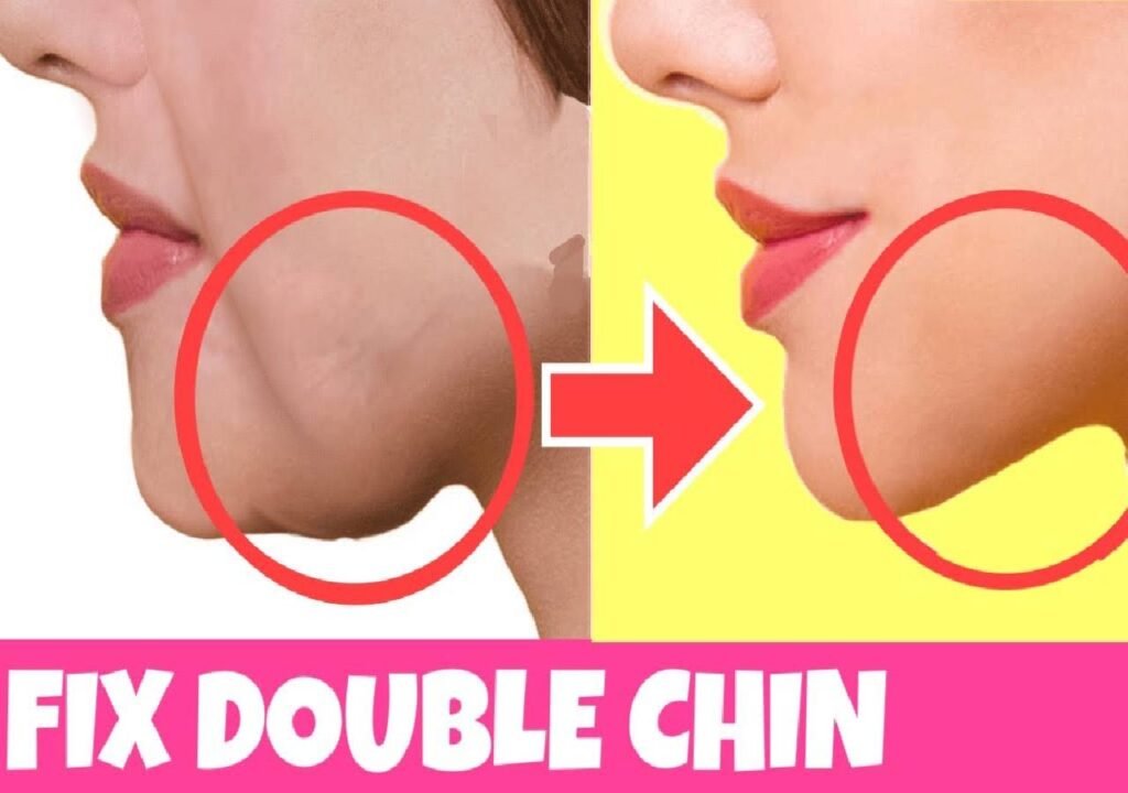 Face Lifting Exercises For Jawline, Double Chin Removal, Sagging Cheeks